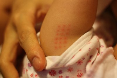 ３-４ヶ月検診+BCG